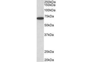 AP31951PU-N HDAC1 antibody staining of HeLa lysate at 0. (HDAC1 antibody  (C-Term))