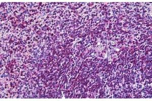 ABIN571017 (3. (ITGAL antibody  (Internal Region))