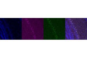 Immunohistochemistry (IHC) image for anti-Corticotropin Releasing Hormone (CRH) antibody (ABIN7455999) (CRH antibody)