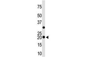 Image no. 1 for anti-Hippocalcin-Like 1 (HPCAL1) (N-Term) antibody (ABIN357110) (HPCAL1 antibody  (N-Term))