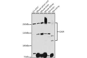 Western blot analysis of extracts of various cell lines, using CASR antibody (ABIN1678994, ABIN5663902, ABIN5663904 and ABIN6218520) at 1:1000 dilution. (CASR antibody  (AA 874-1088))