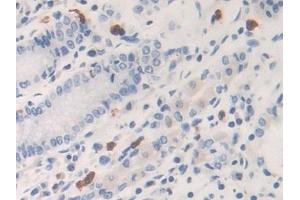 Detection of KLK6 in Human Stomach Tissue using Polyclonal Antibody to Kallikrein 6 (KLK6) (Kallikrein 6 antibody  (AA 17-244))