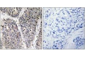 Immunohistochemistry (IHC) image for anti-Neuroblastoma 1, DAN Family BMP Antagonist (NBL1) (AA 131-180) antibody (ABIN1533727)