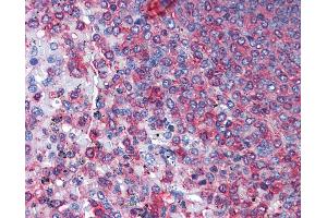Immunohistochemistry (IHC) image for anti-Actin, gamma 1 (ACTG1) (AA 1-119) antibody (ABIN574134)
