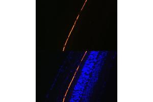Immunofluorescence (IF) image for anti-Retinal Pigment Epithelium-Specific Protein 65kDa (RPE65) antibody (ABIN7269933)