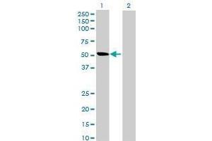 Lane 1: ALDH1L2 transfected lysate ( 53. (ALDH1L2 293T Cell Transient Overexpression Lysate(Denatured))