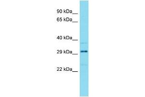 Western Blotting (WB) image for anti-HEAT Repeat Containing 3 (HEATR3) (N-Term) antibody (ABIN2791574) (HEATR3 antibody  (N-Term))