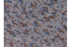 Detection of ATF1 in Mouse Stomach Tissue using Polyclonal Antibody to Activating Transcription Factor 1 (ATF1)