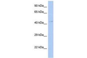 Image no. 1 for anti-Transcription Factor Dp Family, Member 3 (TFDP3) (AA 215-264) antibody (ABIN6742255) (TFDP3 antibody  (AA 215-264))