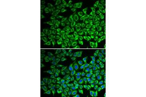 Immunofluorescence analysis of A549 cells using IL12RB1 antibody. (IL12RB1 antibody)