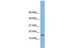 Image no. 1 for anti-Ubiquitin-Conjugating Enzyme E2L 6 (UBE2L6) (C-Term) antibody (ABIN6742062) (UBE2L6 antibody  (C-Term))