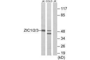 Western blot analysis of extracts from Jurkat cells and COLO cells, using ZIC1/2/3 antibody. (ZIC1 antibody)