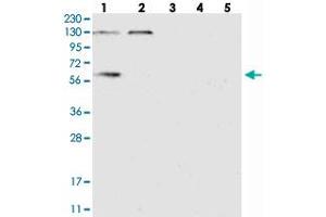 Western blot analysis of Lane 1: RT-4, Lane 2: U-251 MG, Lane 3: Human Plasma, Lane 4: Liver, Lane 5: Tonsil with DYNC1LI1 polyclonal antibody  at 1:250-1:500 dilution. (DYNC1LI1 antibody)