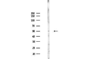 Western blot analysis of lysates from PC12 cells(UV,30 min treatment), using Phospho-XIAP (Ser87) Antibody at 1/1000 dilution.
