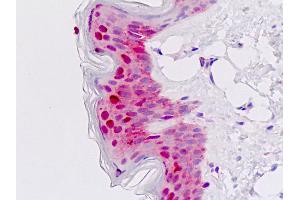 Human Skin: Formalin-Fixed, Paraffin-Embedded (FFPE) (Msx2/Hox8 antibody  (AA 1-30))