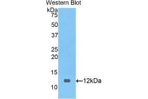 Detection of Recombinant PRAME, Human using Polyclonal Antibody to Preferentially Expressed Antigen In Melanoma (PRAME) (PRAME antibody  (AA 416-502))
