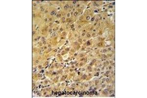 Immunohistochemistry (Paraffin-embedded Sections) (IHC (p)) image for anti-FK506 Binding Protein 1A, 12kDa (FKBP1A) (AA 55-83), (C-Term) antibody (ABIN1882082)