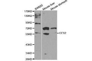 Western blot analysis of extracts of various cell lines, using CES2 antibody. (CES2 antibody  (AA 310-410))