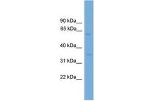 Image no. 1 for anti-Major Facilitator Superfamily Domain Containing 8 (MFSD8) (AA 351-400) antibody (ABIN6745584) (MFSD8 antibody  (AA 351-400))
