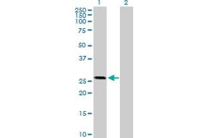 Western Blot analysis of OTUB2 expression in transfected 293T cell line by OTUB2 MaxPab polyclonal antibody. (OTUB2 antibody  (AA 1-234))
