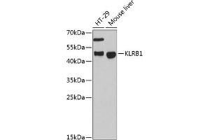 Western blot analysis of extracts of various cell lines, using KLRB1 antibody (ABIN6130055, ABIN6142970, ABIN6142972 and ABIN6222669) at 1:3000 dilution. (CD161 antibody  (AA 73-140))