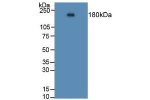 Rabbit Capture antibody from the kit in WB with Positive Control: Human lung tissue.