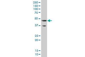 GATA3 monoclonal antibody (M09), clone 3A4. (GATA3 antibody  (AA 103-200))