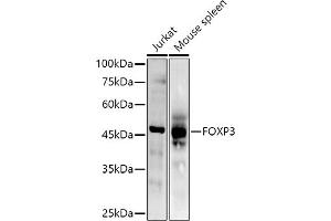 Western blot analysis of extracts of various cell lines, using (ABIN6133706, ABIN6140764, ABIN6140767 and ABIN6215622) at 1:500 dilution. (FOXP3 antibody  (AA 50-150))