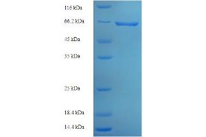 Glyco (AA 20-459) protein (His-SUMO Tag)