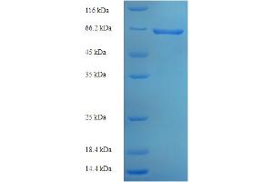 SDS-PAGE (SDS) image for Glyco (AA 20-459) protein (His-SUMO Tag) (ABIN5711133)