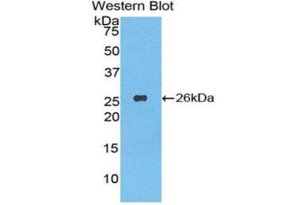 LAP anticorps  (AA 320-519)