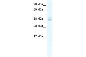 WB Suggested Anti-TSG101 Antibody Titration:  2. (TSG101 antibody  (Middle Region))