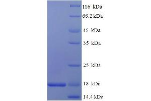 SDS-PAGE (SDS) image for Niemann-Pick Disease, Type C2 (NPC2) (AA 22-149) protein (His tag) (ABIN4975228) (NPC2 Protein (AA 22-149) (His tag))