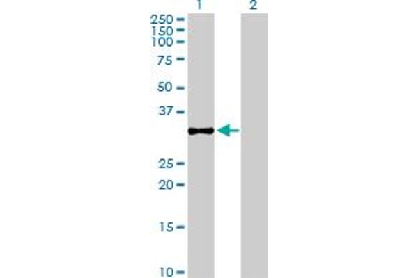 CSGALNACT1 antibody  (AA 1-297)