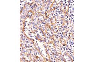 Paraformaldehyde-fixed, paraffin embedded human spleen tissue, Antigen retrieval by boiling in sodium citrate buffer (pH6. (PPP2R1B antibody)