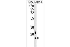 LHPL3 Antibody (C-term) (ABIN651908 and ABIN2840448) western blot analysis in MDA-M cell line lysates (15 μg/lane). (LHFPL3 antibody  (C-Term))
