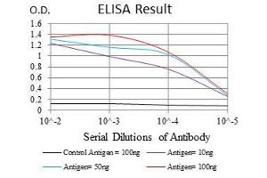 Black line: Control Antigen (100 ng), Purple line: Antigen(10 ng), Blue line: Antigen (50 ng), Red line: Antigen (100 ng), (BMI1 antibody)