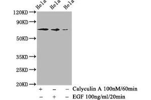 Western Blot Positive WB detected in Hela whole cell lysate(treated with Calyculin A or EGF) All lanes Phospho-RAF1 antibody at 1. (Recombinant RAF1 antibody  (pSer259))