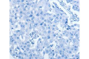 Immunohistochemistry (IHC) image for anti-Lipocalin 2 (LCN2) antibody (ABIN1873522) (Lipocalin 2 antibody)