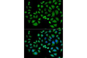 Immunofluorescence analysis of HeLa cells using CLIC1 antibody. (CLIC1 antibody)
