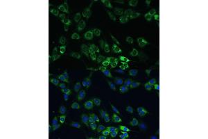 Immunofluorescence analysis of C6 cells using USP46 Polyclonal Antibody (ABIN7271165) at dilution of 1:100 (40x lens).