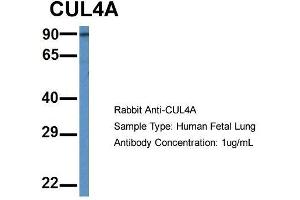 Host: Rabbit  Target Name: CUL4A  Sample Tissue: Human Fetal Lung  Antibody Dilution: 1. (Cullin 4A antibody  (Middle Region))