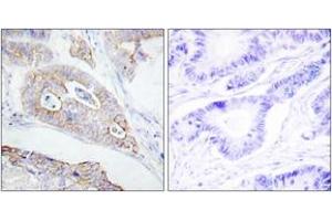 Immunohistochemistry (IHC) image for anti-Protein tyrosine Phosphatase, Receptor Type, C (PTPRC) (AA 981-1030) antibody (ABIN1532560)