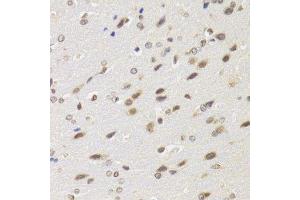 Immunohistochemistry of paraffin-embedded rat brain using BAZ1B antibody. (BAZ1B antibody  (AA 1-260))