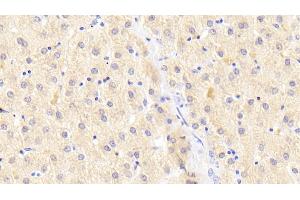 Immunohistochemistry (IHC) image for anti-ATG16 Autophagy Related 16-Like 1 (ATG16L1) (AA 1-284) antibody (ABIN7430186)