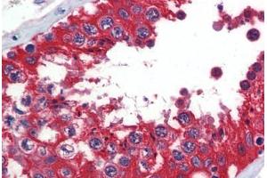 Human Testis (formalin-fixed, paraffin-embedded) stained with  antibody ABIN462273 followed by biotinylated secondary antibody, alkaline phosphatase-streptavidin and chromogen. (Glucose-6-Phosphate Dehydrogenase antibody  (AA 35-506))