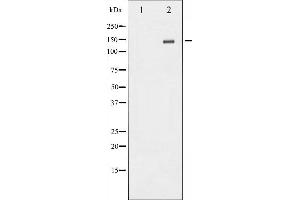 Western blot analysis of NMDAR2B phosphorylation expression in TNF treated Jurkat whole cell lysates,The lane on the left is treated with the antigen-specific peptide. (GRIN2B antibody  (pTyr1336))