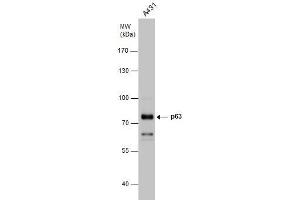 WB Image p63 antibody detects p63 protein by western blot analysis.