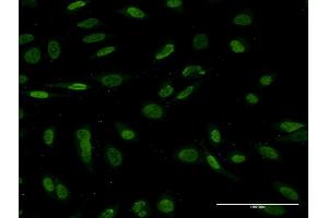 Immunofluorescence of monoclonal antibody to NKX2-1 on HeLa cell. (NKX2-1 antibody  (AA 77-158))