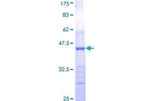 HAPLN2 Protein (AA 31-142) (GST tag)